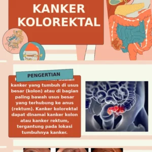 Ancaman Kanker Kolorektal: Kenali Gejala, Manfaat Tes FIT, dan Peran Teknologi Nuklir dalam Deteksi Dini