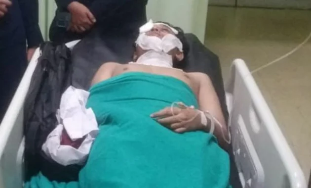 Bagian Mata Luka Parah Akibat Siraman Air Keras, Andrie Yunus Terancam Cacat Permanen