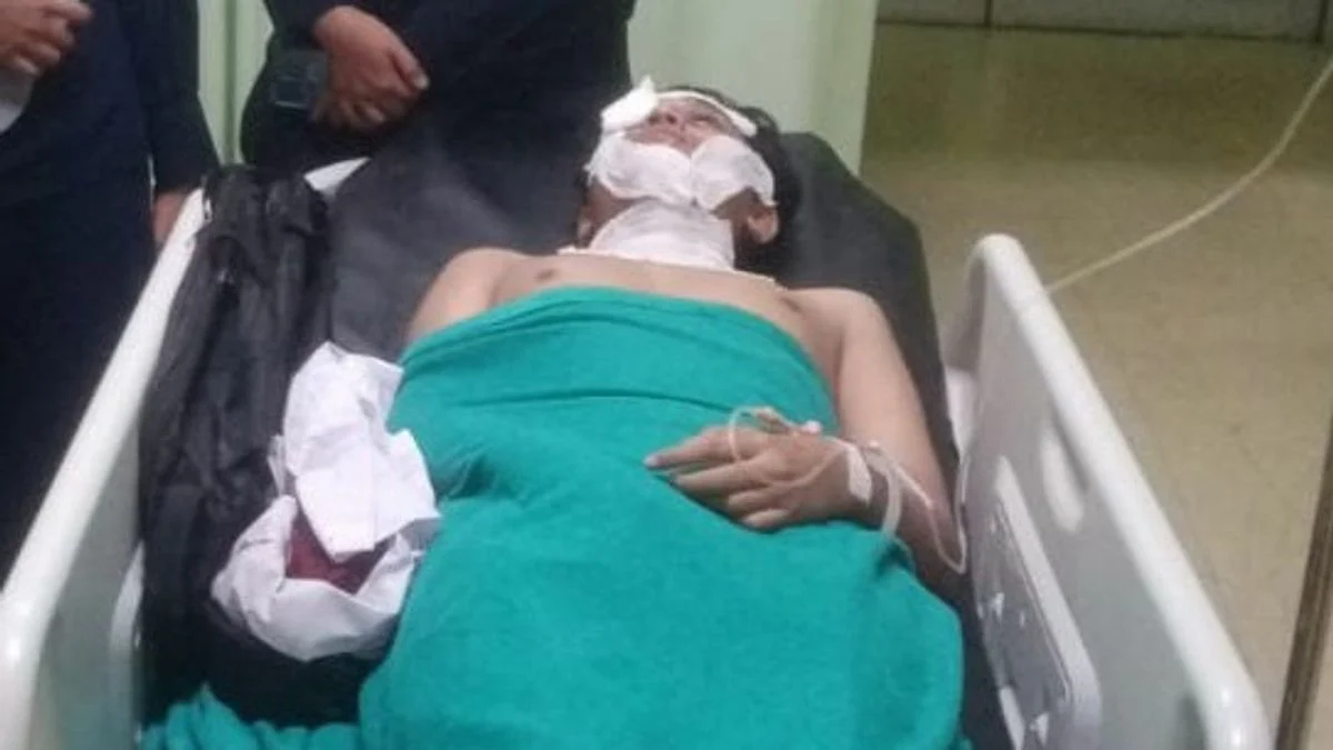 Bagian Mata Luka Parah Akibat Siraman Air Keras, Andrie Yunus Terancam Cacat Permanen