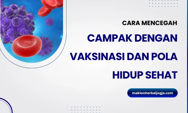 Edukasi dan Vaksinasi: Investasi Penting untuk Mencegah Wabah Campak