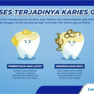 Mengejutkan! 10 Penyakit Mematikan di Dunia, Karies Gigi Ungguli Semua