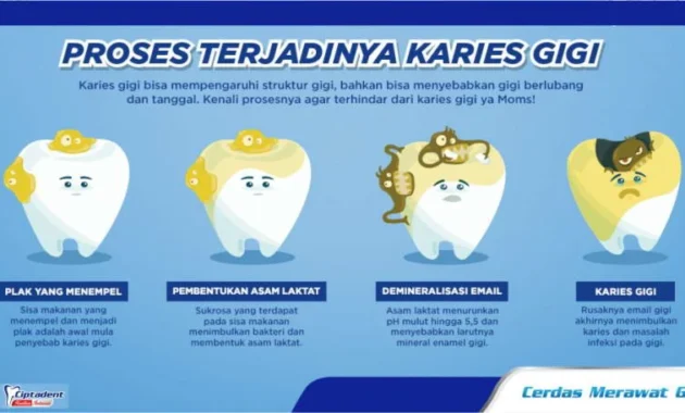 Mengejutkan! 10 Penyakit Mematikan di Dunia, Karies Gigi Ungguli Semua