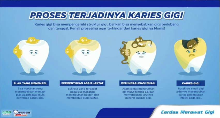 Mengejutkan! 10 Penyakit Mematikan di Dunia, Karies Gigi Ungguli Semua