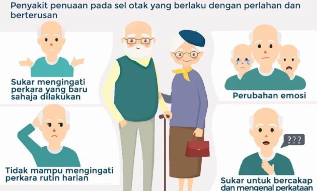Riset: Tak Mampu Mengingat Mimpi Bisa Jadi Gerbang Awal Tuju Alzheimer