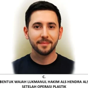 Bareskrim Ajukan Red Notice Interpol Terhadap Penyuplai Sabu "The Doctor"
