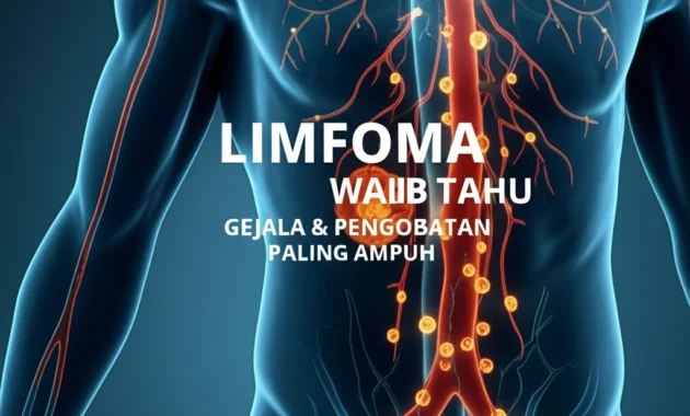 Beragam Pengobatan Limfoma, Mana yang Paling Tepat?