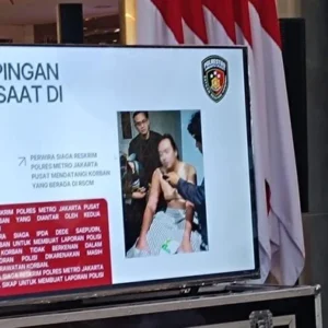 Dokter RSCM Ungkap Kondisi Mata Andrie Yunus Hanya Bisa Melihat Cahaya, Tidak Mampu Membaca Huruf