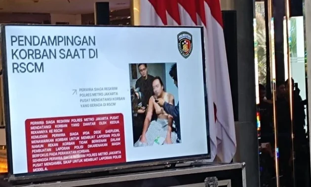 Dokter RSCM Ungkap Kondisi Mata Andrie Yunus Hanya Bisa Melihat Cahaya, Tidak Mampu Membaca Huruf Dokter RSCM Ungkap Kondisi Mata Andrie Yunus Hanya Bisa Melihat Cahaya, Tidak Mampu Membaca Huruf