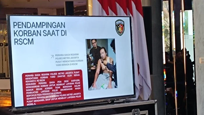 Dokter RSCM Ungkap Kondisi Mata Andrie Yunus Hanya Bisa Melihat Cahaya, Tidak Mampu Membaca Huruf