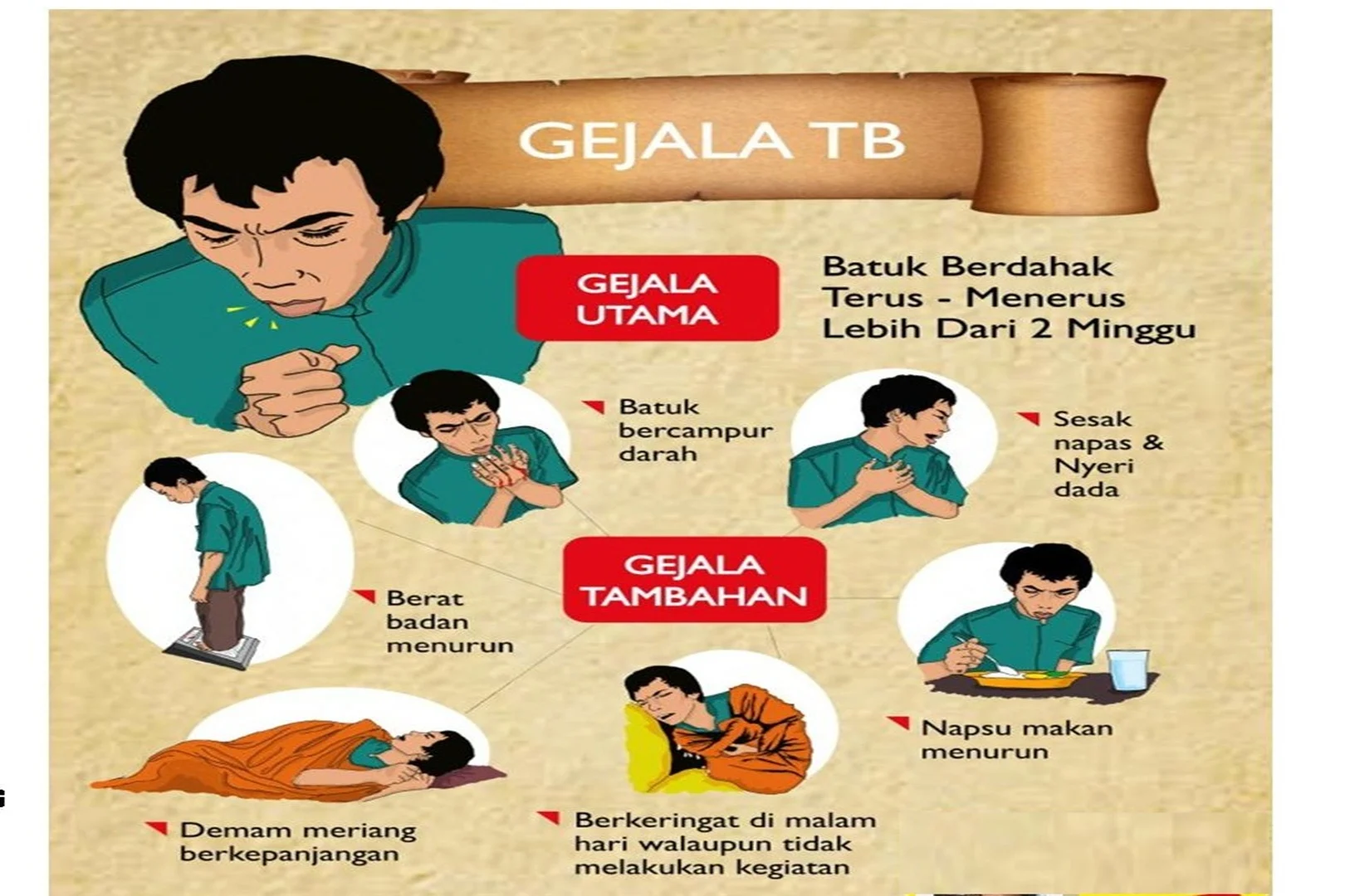 Waspada! Ini 5 Gejala TBC, Batuk Lebih dari 2 Minggu Jadi Tanda Utama
