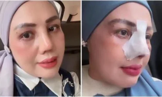 Elly Sugigi Jawaban Menohok Usai Disentil Anak Karena Oplas: Mama Kerja Bayar Mobil